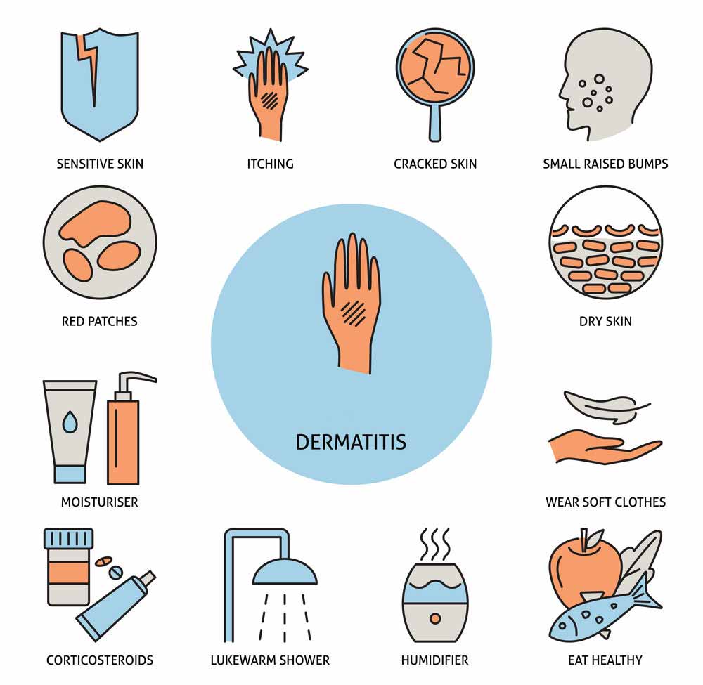 dermatitis - simptomi